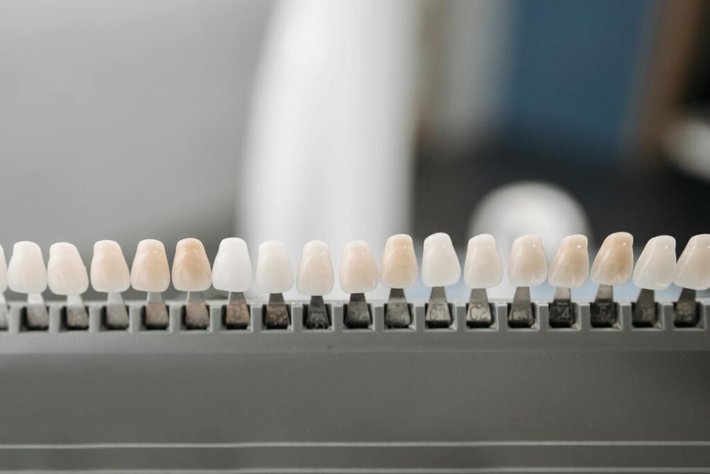 Protesis Dental Belloch Alcorcón Close-up of dental veneers arranged neatly on a display rack in a dental office setting.